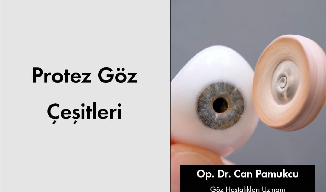 Göz kaybı, yaşam kalitesini etkileyen ciddi bir durum olabilir. Ancak,