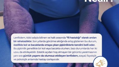 Lenfödem, halk arasında “fil hastalığı” olarak bilinen bir sağlık sorunudur.