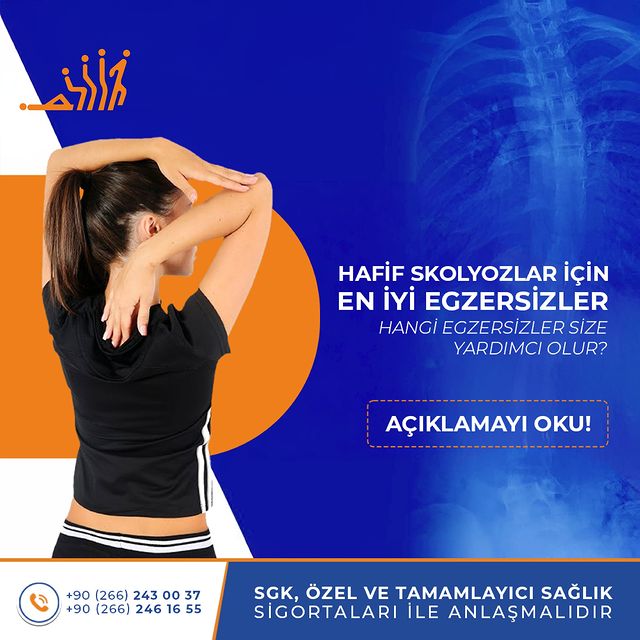 Hafif skolyoz, ergenlik döneminde fark edilmezken omurgada meydana gelen hafif